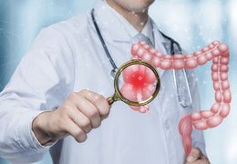 Včasnými záchyty polypů dál zachraňujeme životy