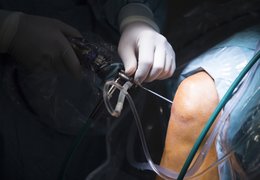 Týdně provádíme na čtyři desítky plánovaných operací