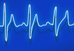 Upozornění pro pacienty, kteří půjdou na EKG 