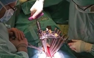 Lékaři KHN operují pomocí systému Ennovate od společnosti B. Braun.